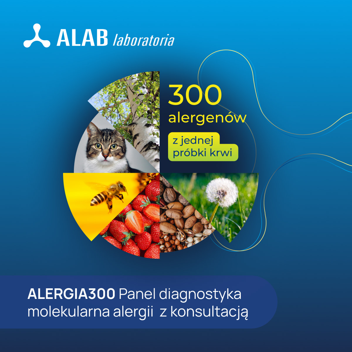 Alergia 300 - Panel diagnostyka molekularna alergii ALEX3 z konsultacją